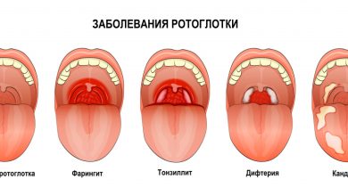 Photo of Популярные методы борьбы с ангиной