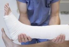 Photo of Как вернуть подвижность суставов после травмы