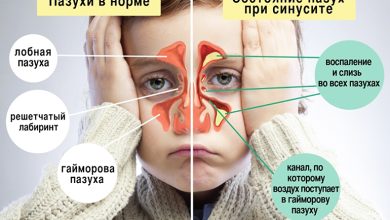 Photo of Как справиться с сильным насморком