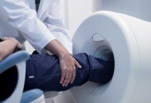 Photo of Инновационные методы борьбы с пяточной шпорой