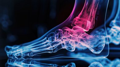 Photo of Методы лечения остеоартрита стоп
