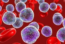 Photo of Эффективные методы лечения рака